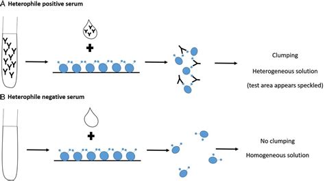 Heterophile antibody test